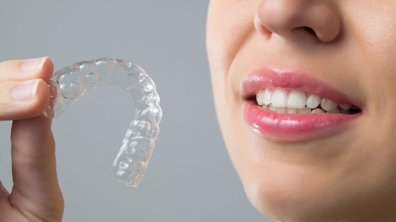 Invisalign 3D ψηφιακή εκτύπωση με διαφανείς νάρθηκες