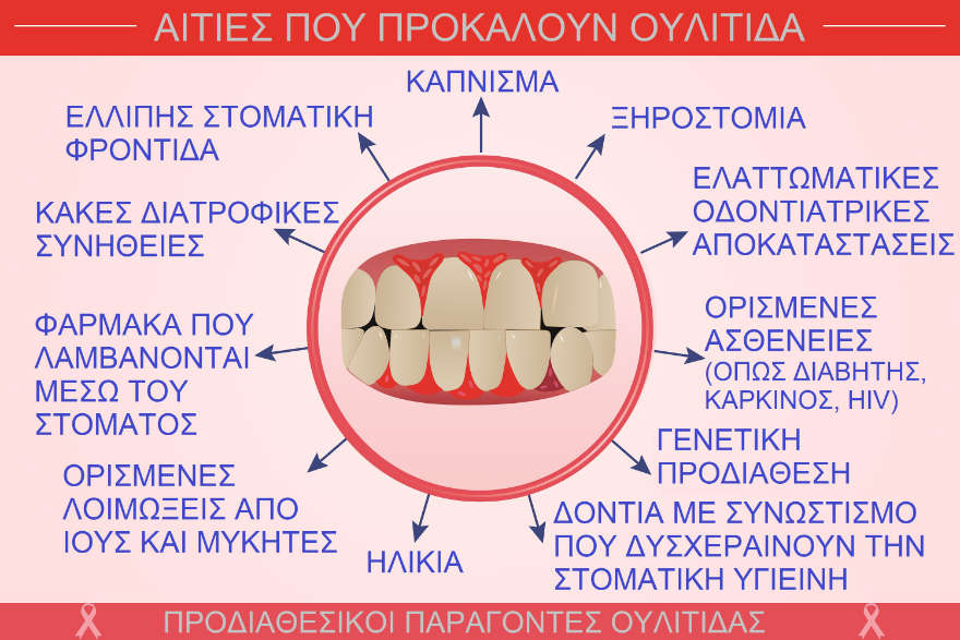 Αιτίες που προκαλούν ουλίτιδα